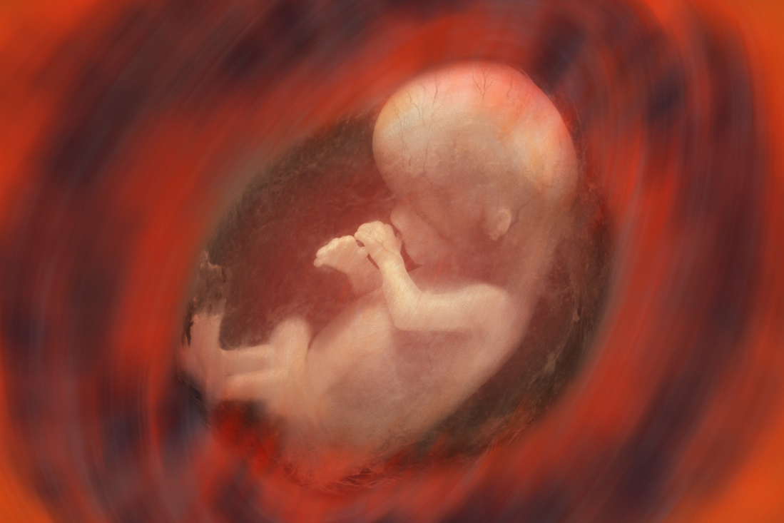 Internal view of a human fetus - approx. 10 weeks